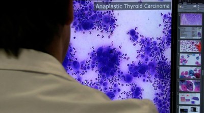 El Premi UPC de Valorització de la Recerca distingeix una família d'algoritmes per millorar el diagnòstic del càncer, un catalitzador i una 'spin-off' que ajuda a formar personal sanitari