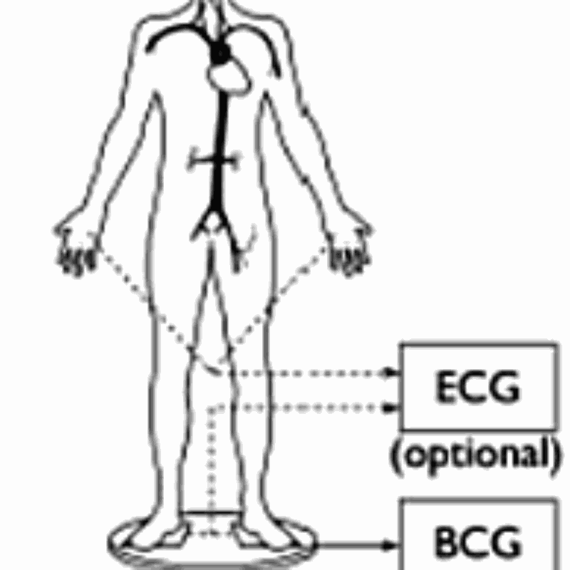 Cardiovascular health assessment from a common electronic weighing scale. MKT2016/0159_H