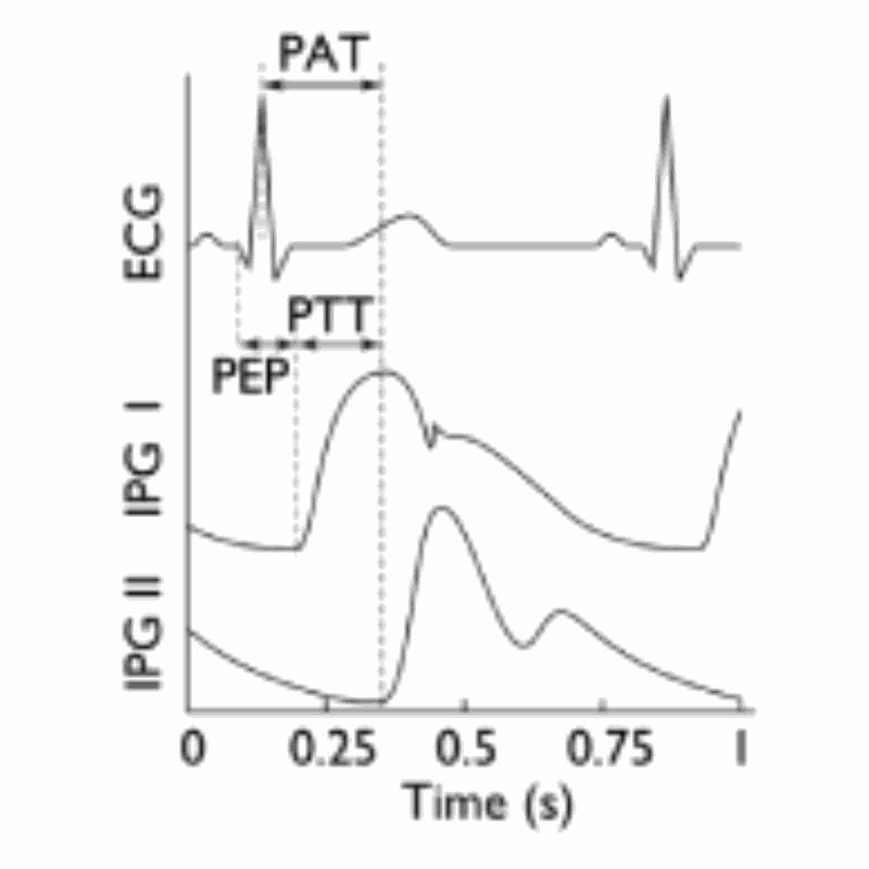 Electronic cardioarteriograph. MKT2021/0186_H