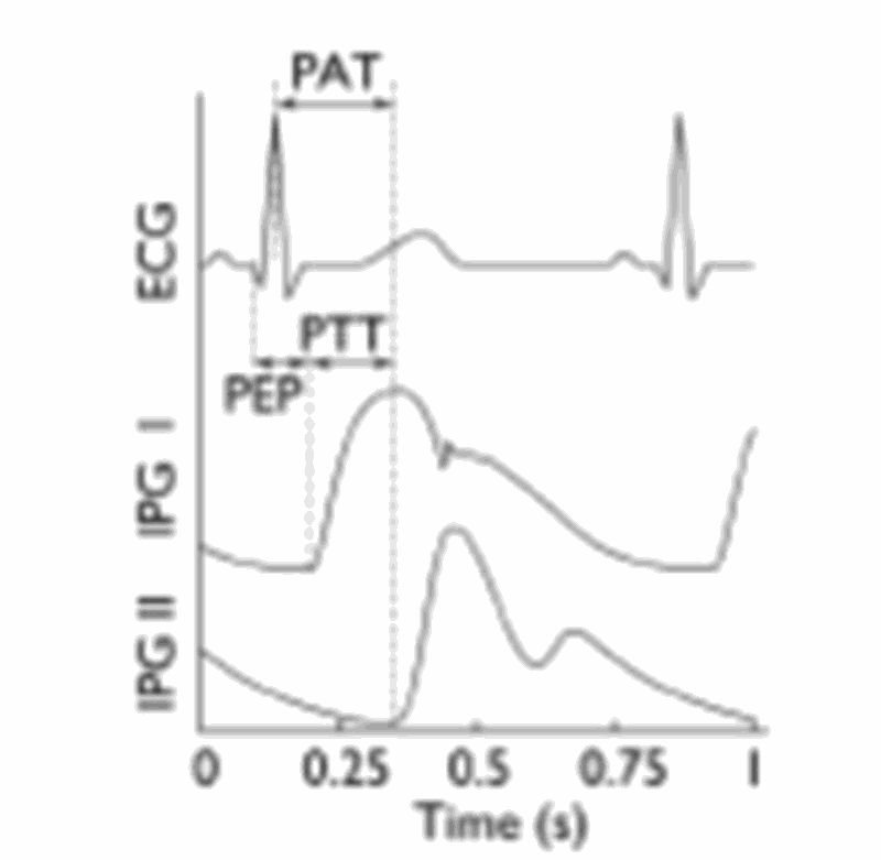 Fast cardiovascular condition assessment. MKT2016//0160_ H