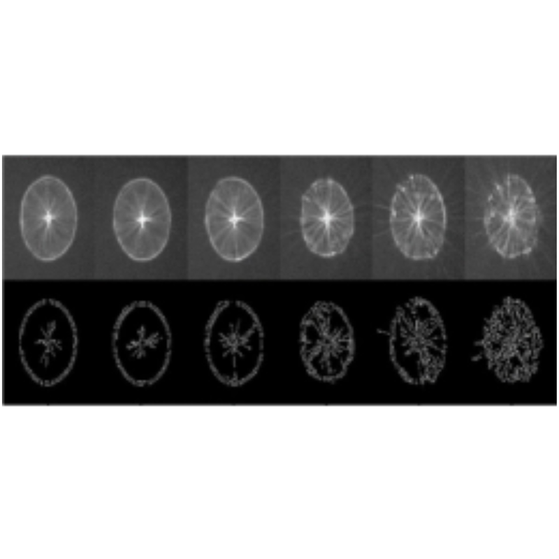 Non-invasive method to objectively determine the dynamics of the tear film and diagnose dryeye disease (DED). MKT2019/0164_H