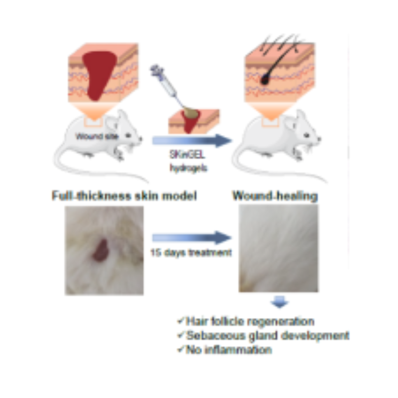 Nanoenabled Hydrogels for Advanced Skin Care : SKinGEL. MKT2021/0182_H