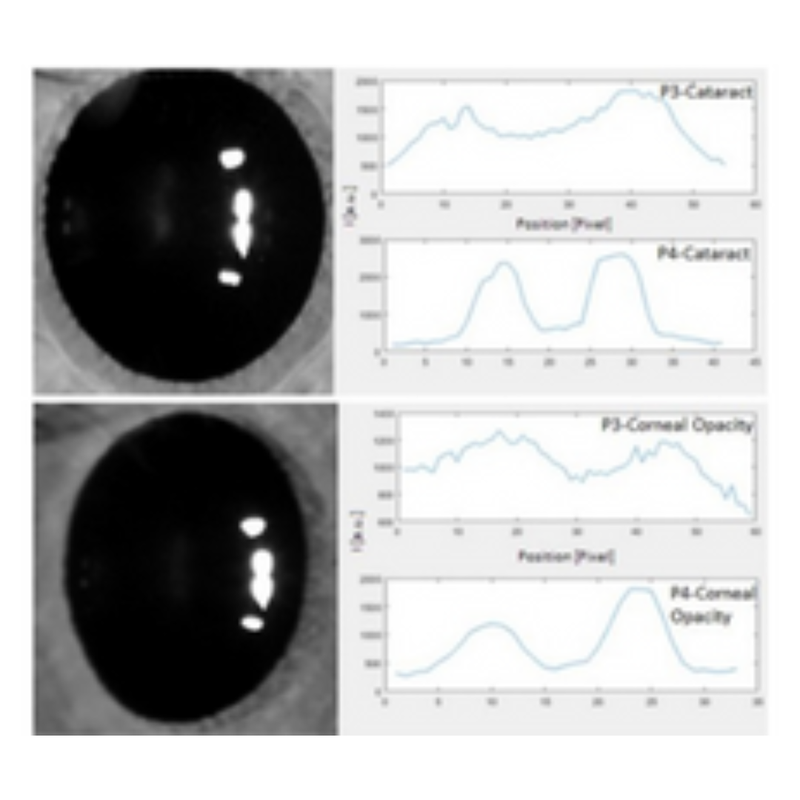Non–invasive method for the objective assessment of the intraocular scattering of the cornea and the crystaline lens. MKT2019/0165_I
