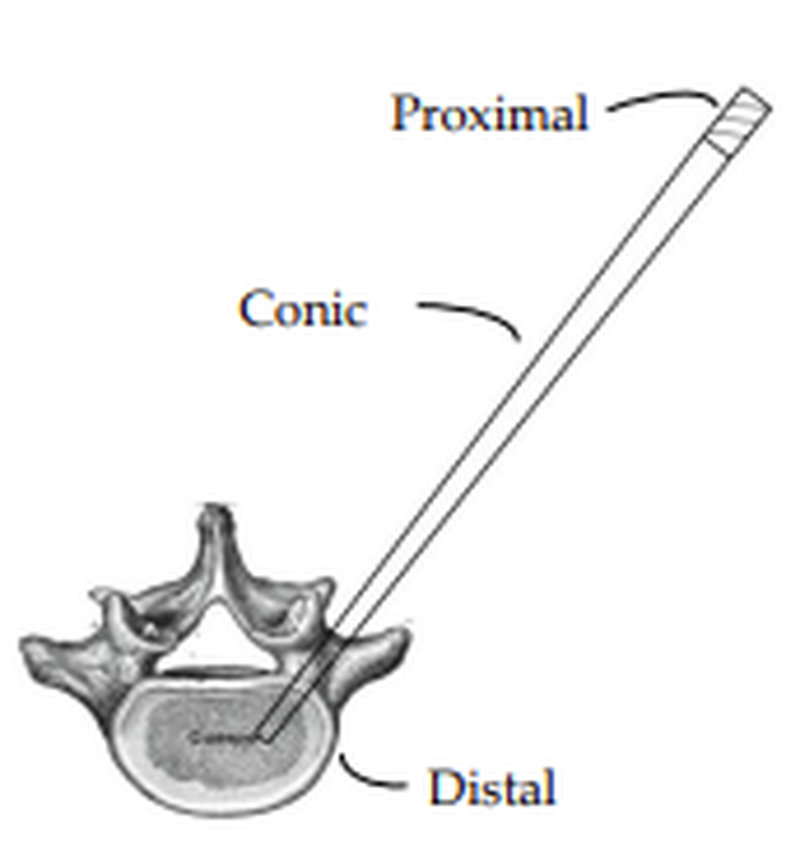 Novel conic cannula for spine cement injection. MKT2014/0152_H